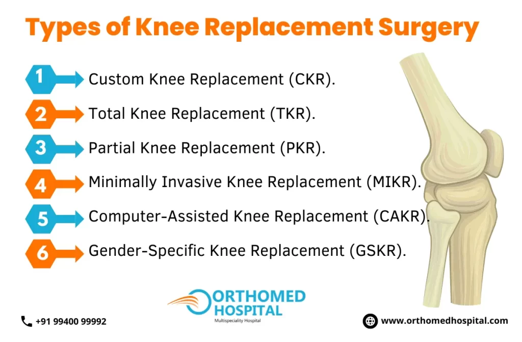 Best Knee Replacement Surgeons in Chennai
