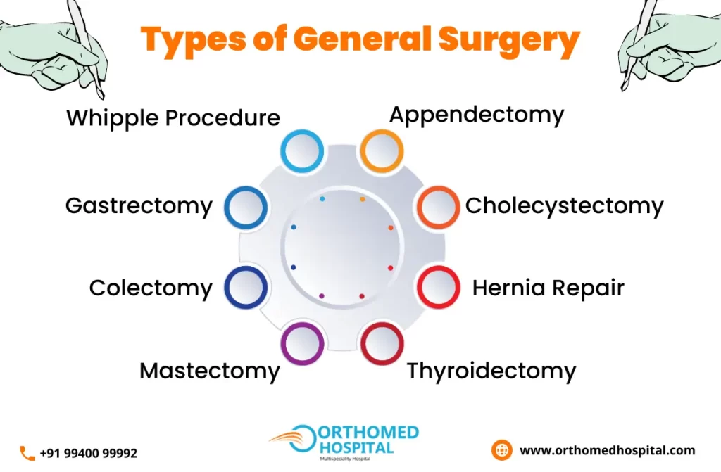 General Surgery in Chennai | Orthomed Hospital