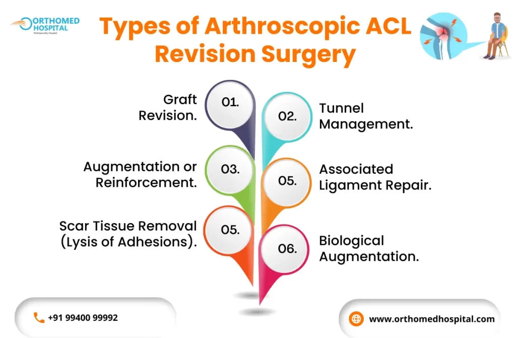 Arthroscopic ACL Revision Surgery in Chennai | Orthomed Hospital